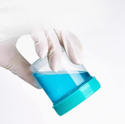 Disposable Plastic Screw-Mouth Covered Sample and Specimen Cups Biological Sterile