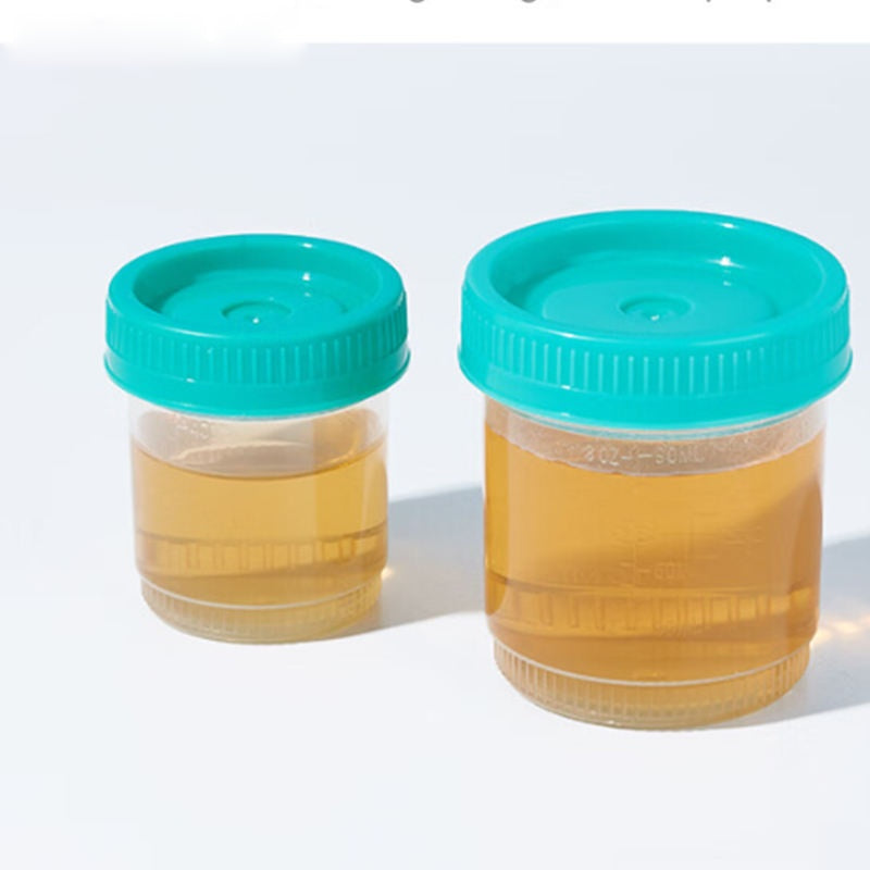 PP Material Sterile Specimen Cup 20mL 40mL 60mL 90mL 120mL 160mL Laboratory Bottles Sampling Cup