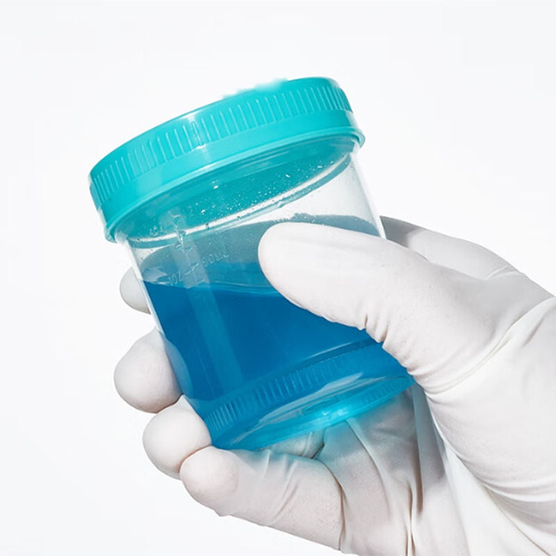 PP Material Sterile Specimen Cup 20mL 40mL 60mL 90mL 120mL 160mL Laboratory Bottles Sampling Cup