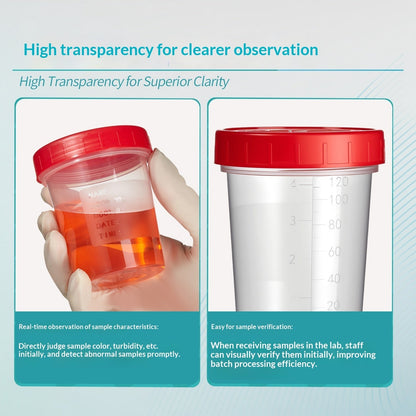 Disposable Stacked Screw Lid Sampling Cups for Urine Sputum & Dirty Samples